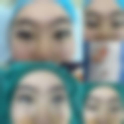 七、苏州爱思特医疗整形美容医院价格表：（仅供参考）