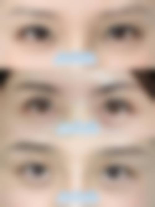 三、荆门市第一人民医院医学美容中 心医生介绍: