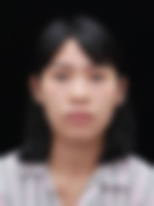 五、Jelim整形外科实例