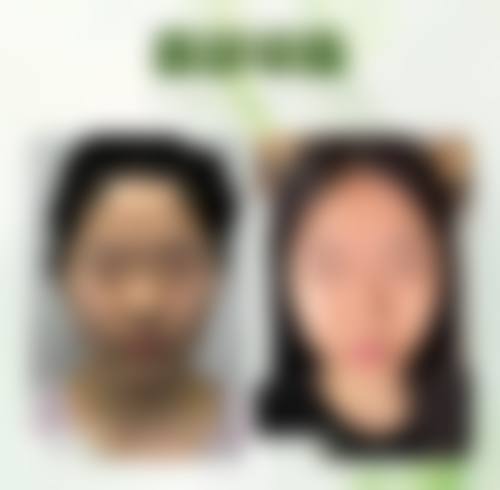 六、天津市第三中 心医院整形美容科怎么预约：