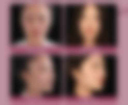 杨颖辉医生实例