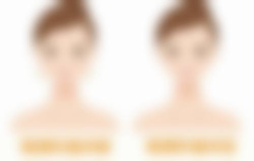 割双眼皮其他相关说明别错过