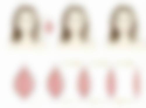 割双眼皮修复阶段与护理要点全知道