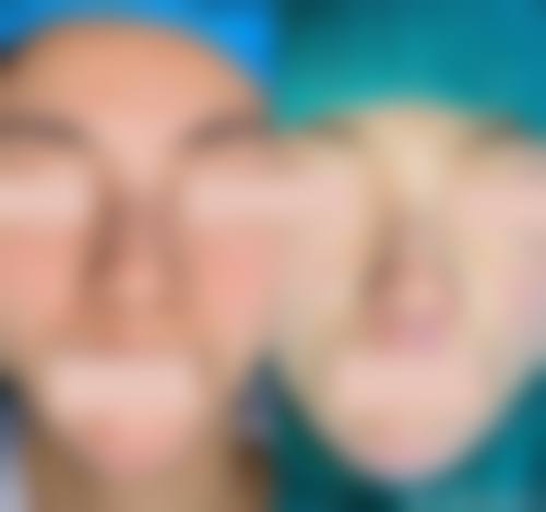 八、东莞市逸美医疗美容门诊部真实的顾客评价如下：