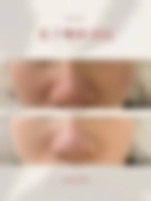 六、东莞市逸美医疗美容门诊部怎么预约：