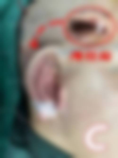 七、焦作市妇幼保健院整形美容中 心价格表：（仅供参考）