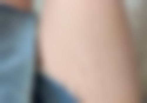 七、新乡医学校第三附属医院皮肤科价格表：（仅供参考）