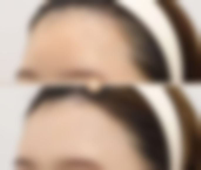 五、北京牛山之木医疗美容诊所实例