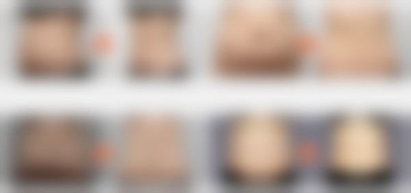 李爱林（大邱院营养师）医生怎么样可靠吗？