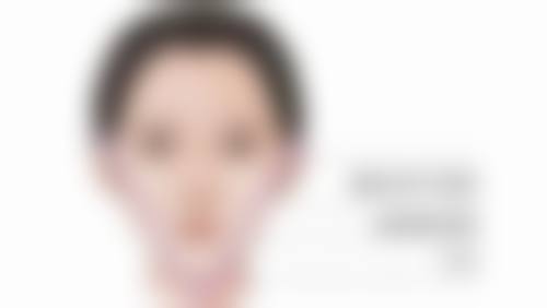 注射隆鼻能否恒久？所谓“恒久性”材料的真相