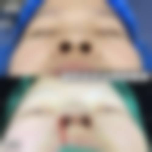 四、杭州德米尔医疗美容诊所实例