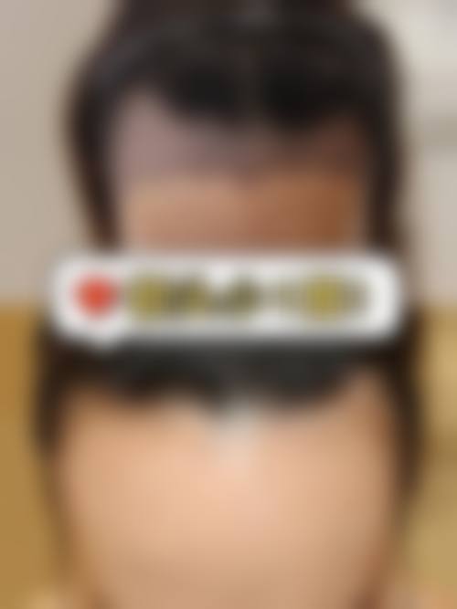 七、临沂瑞丽整形美容医院价格表：（仅供参考）