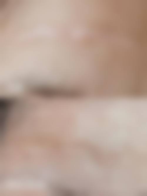 六、锡林郭勒盟中 心医院(医学美容科)价格表：（仅供参考）