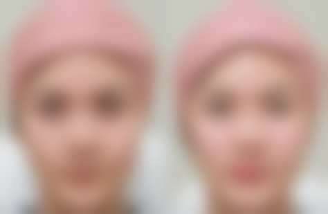 五、杭州德米尔医疗美容诊所怎么预约：