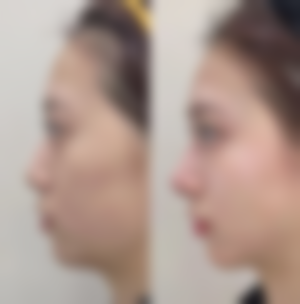 七、杭州德米尔医疗美容诊所真实的顾客评价如下：