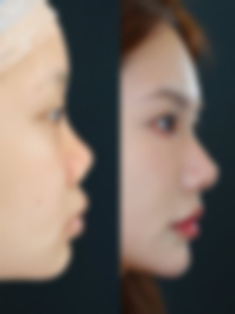 七、营口星禾整形医院真实的顾客评价如下：