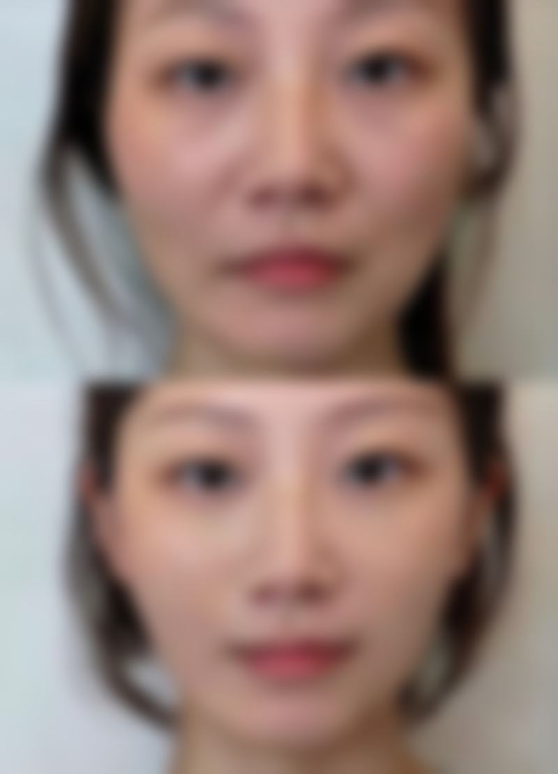 黄伟荣医生实例