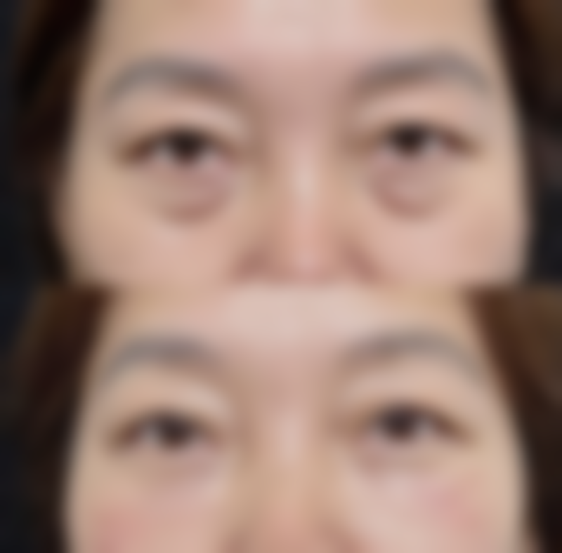 胡瑞斌医生怎么样可靠吗？