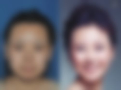 五、深圳盛美佳整形医院实例