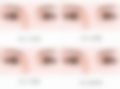 做去眼袋手术要注意啥？伤口护理、冷热敷及饮食调整等方面细节全揭秘 