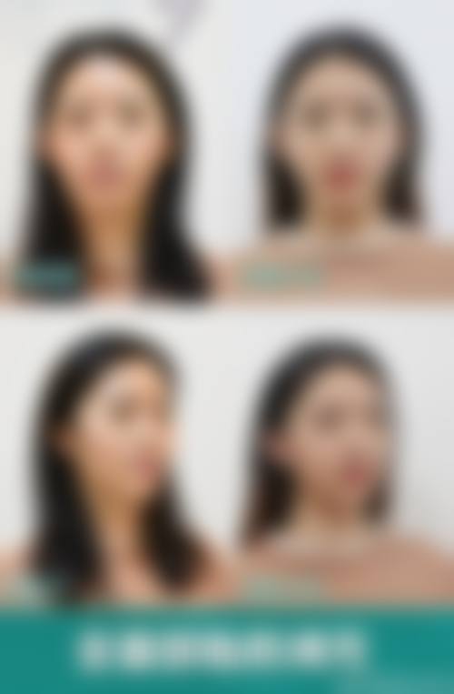 三、广州微雨医疗美容门诊部医生介绍: