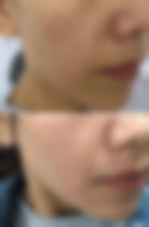 六、大连华医医疗整形美容中 心怎么预约：