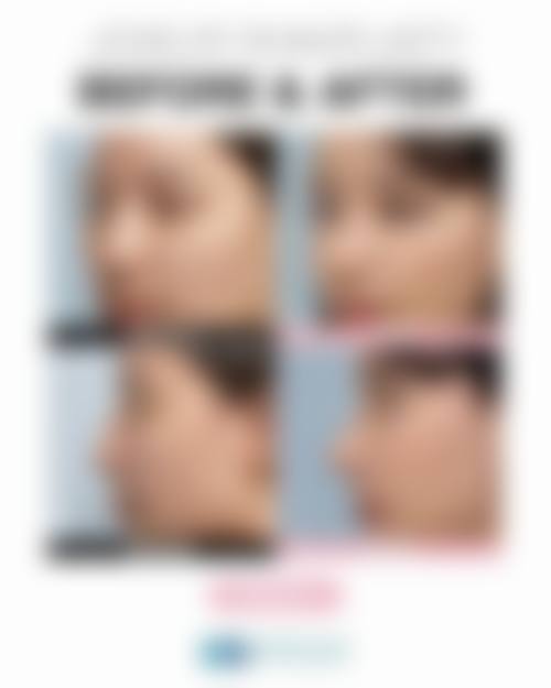 六、孝感安丽尔医疗美容诊所价格表：（仅供参考）