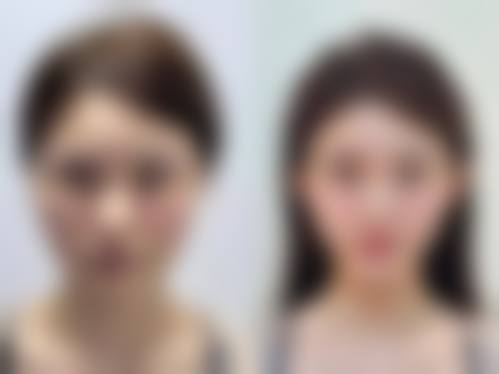 周斌医生在哪家医院怎么预约？