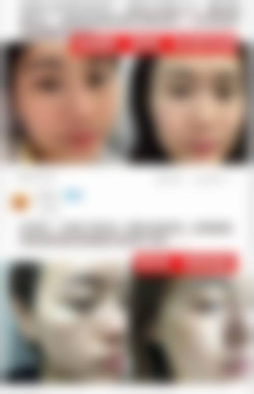 八、娜人皮肤科真实的顾客评价如下：