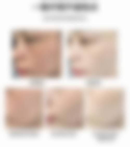 五、娜人皮肤科实例