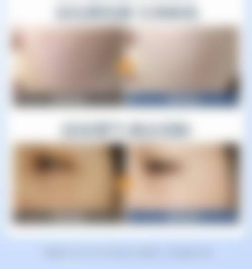 七、娜人皮肤科价格表：（仅供参考）