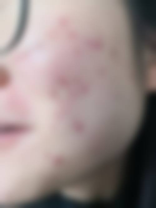 六、娜人皮肤科怎么预约：