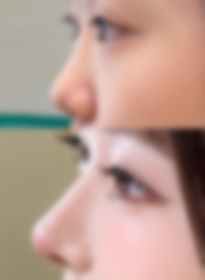 去眼袋黑眼圈，精细选购指南来帮忙