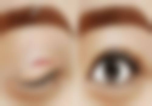 五、广州星面孔医疗美容门诊实例