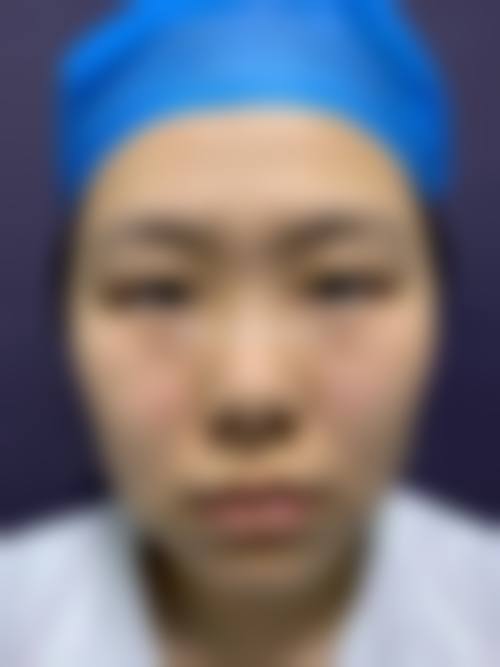 六、巴中系美整形医院怎么预约：