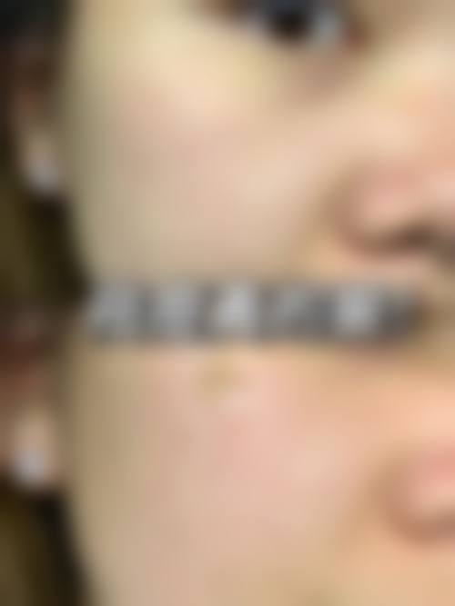 六、昆明薇诺娜皮肤医疗美容门诊部怎么预约：