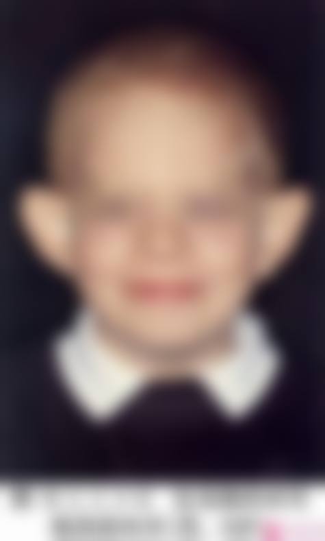 五、徐州王莹整形医疗美容诊所实例