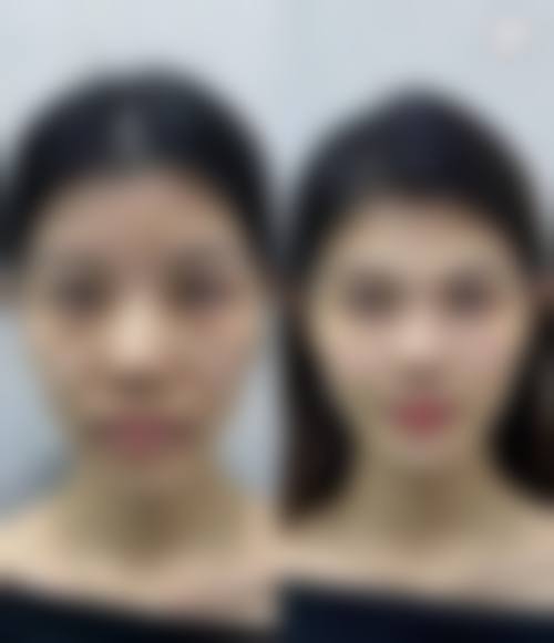 姚方医生在哪家医院怎么预约？