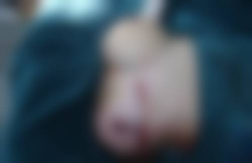 刘喻平医生口碑和评价