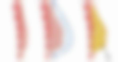 眼袋重度不用愁，眼霜选购有核心原则