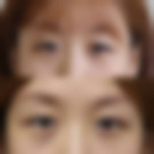 五、天津缪慈整形医疗美容门诊部实例