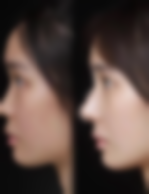 五、武汉黛美嘉整形医院怎么预约：