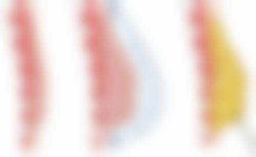 怎样巧妙修复腋下手术疤痕？借助按摩手法，促进疤痕修复平滑