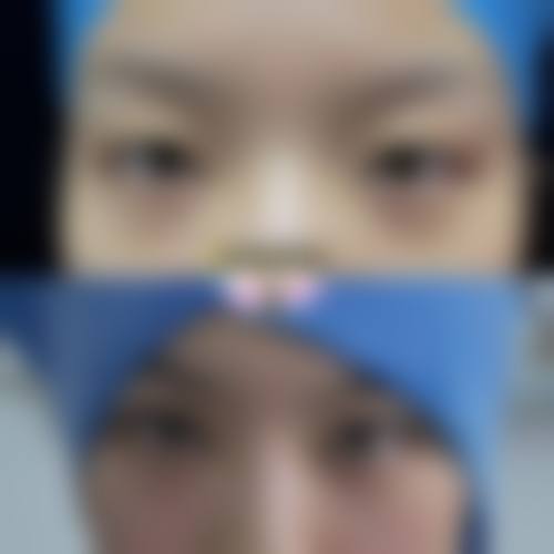 六、合肥友好医院医学美容科怎么预约：