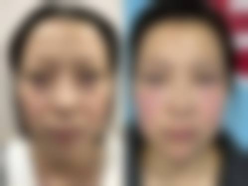 五、济南心艺医疗美容医院实例