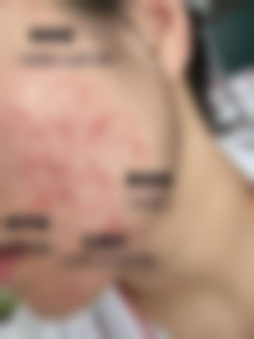 裴飒医生怎么样可靠吗？