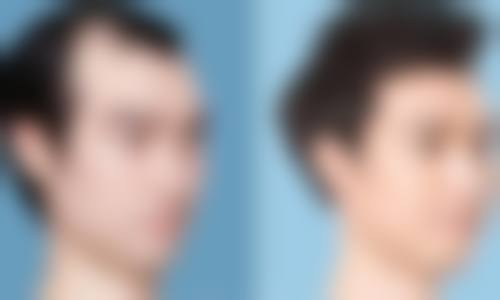 七、韩国可丽妮皮肤科整形外科价格表：（仅供参考）