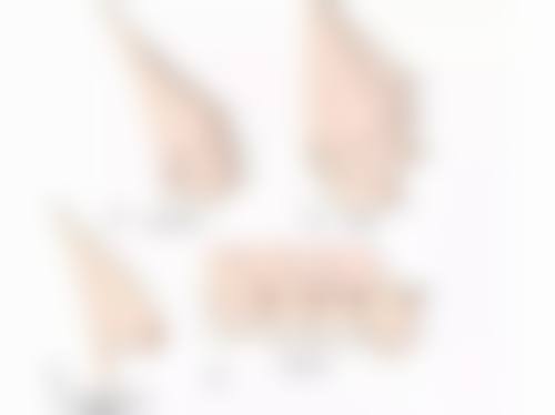 隆胸副作用大揭秘：自体脂肪隆胸隐患