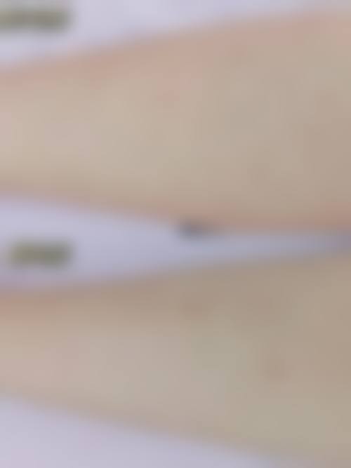 康学培医生在哪家医院怎么预约？