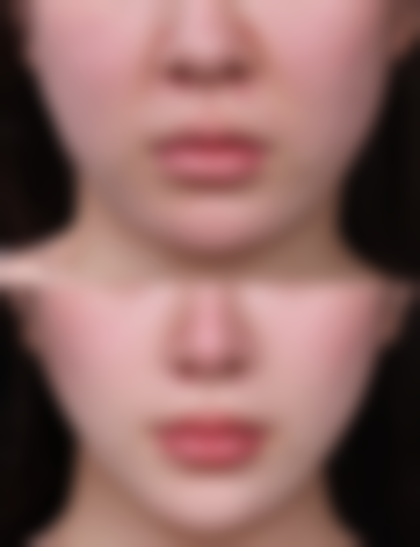 六、东莞南城柏妍美整形医院价格表：（仅供参考）